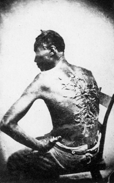 Slave treatment