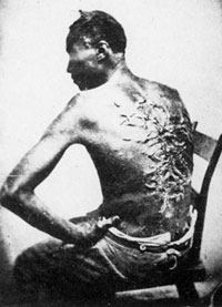 Slave treatment